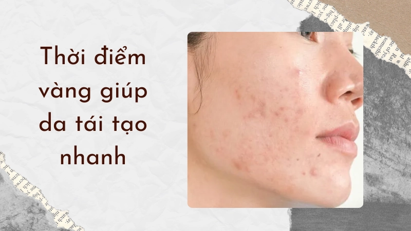 Tận dụng thời điểm vàng để ngăn ngừa thâm mụn lâu năm