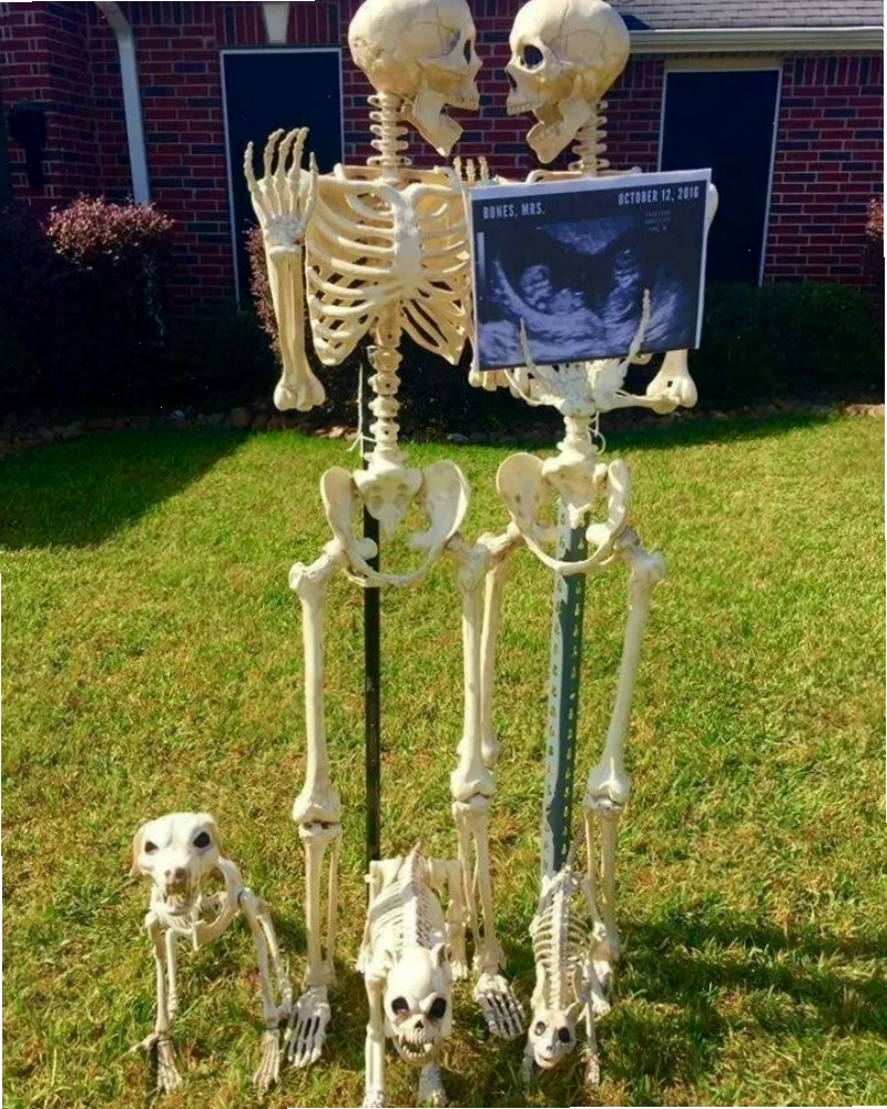 Giải thích về Skeleton Meme