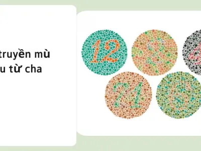 Sự thật về gen mù màu và nguy cơ di truyền bạn nên biết