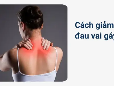 Cách tôi chữa trị Đau vai gáy dứt điểm và hiệu quả nhất